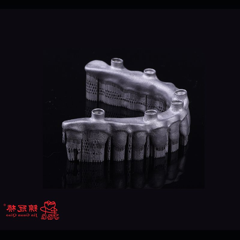 3D Digital Titanium Framework for Dental Implant Supported