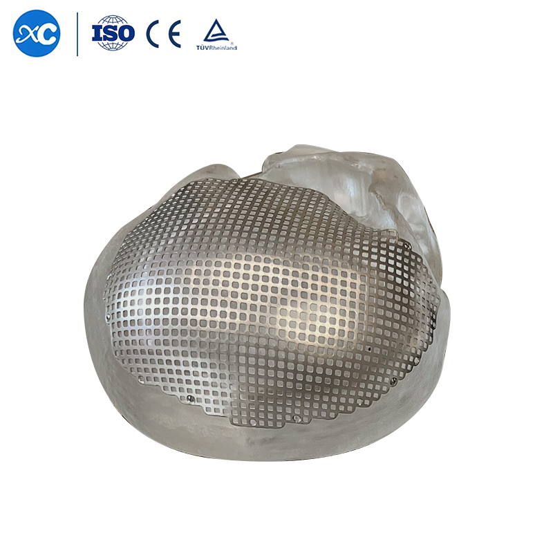 Neurosurgery Skull Mesh Cranial Skull Restoration System Anatomical 3D Titanium Mesh