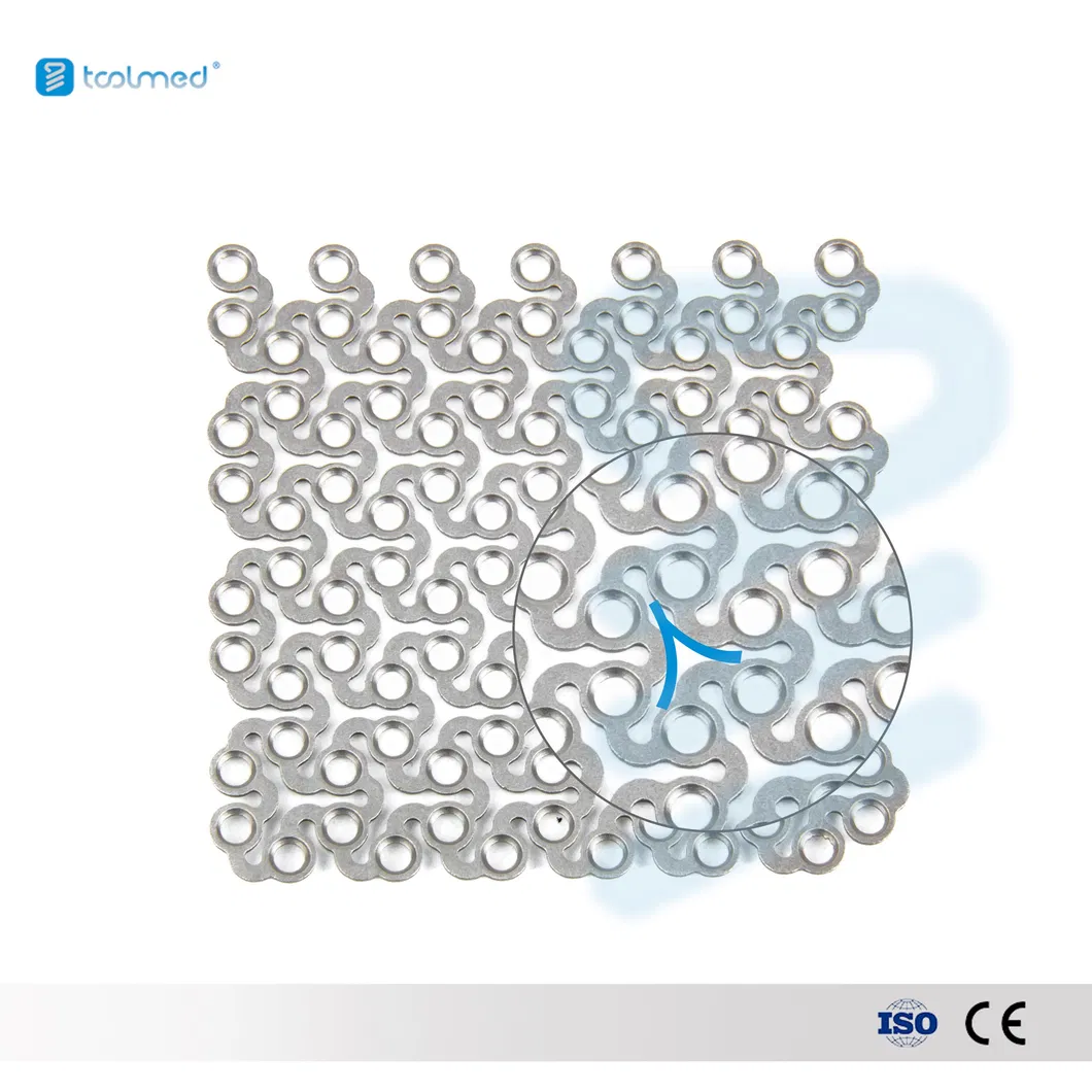 Titanium Mesh Application