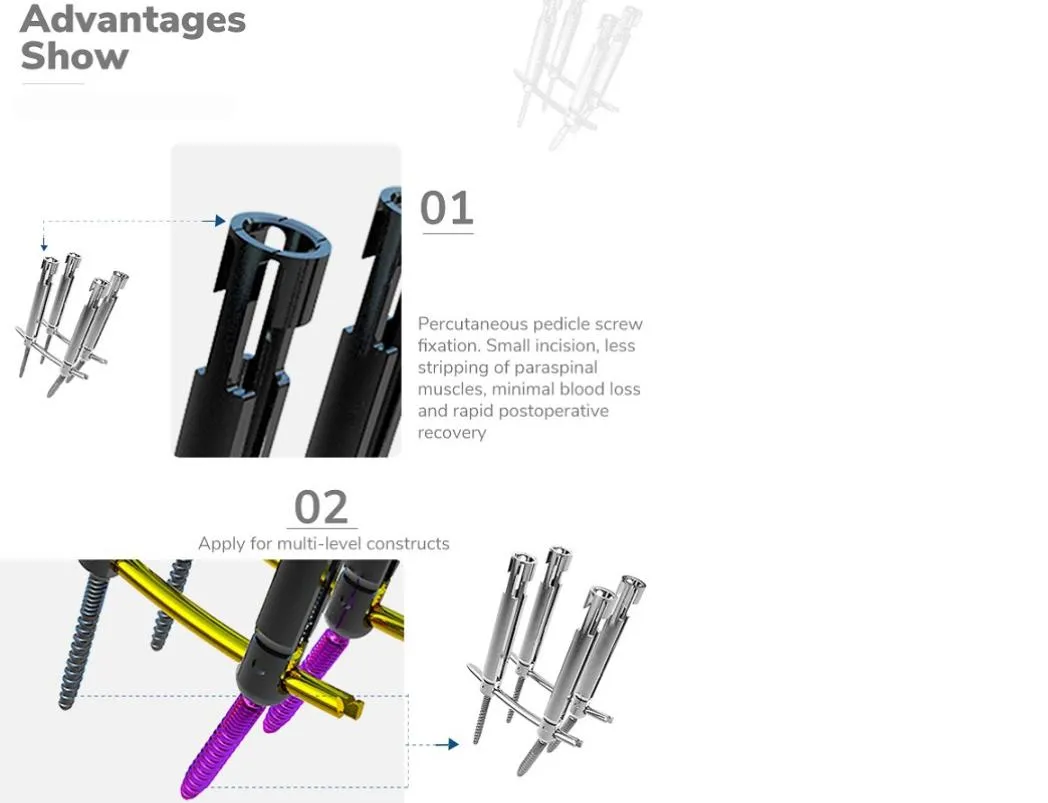 Pedicle Screw System