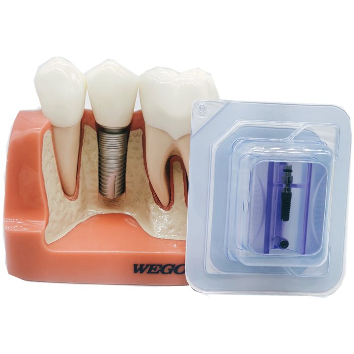 Cheap Tooth Implant Wego Implant Dental Inexpensive SLA Dental Implant Titanium