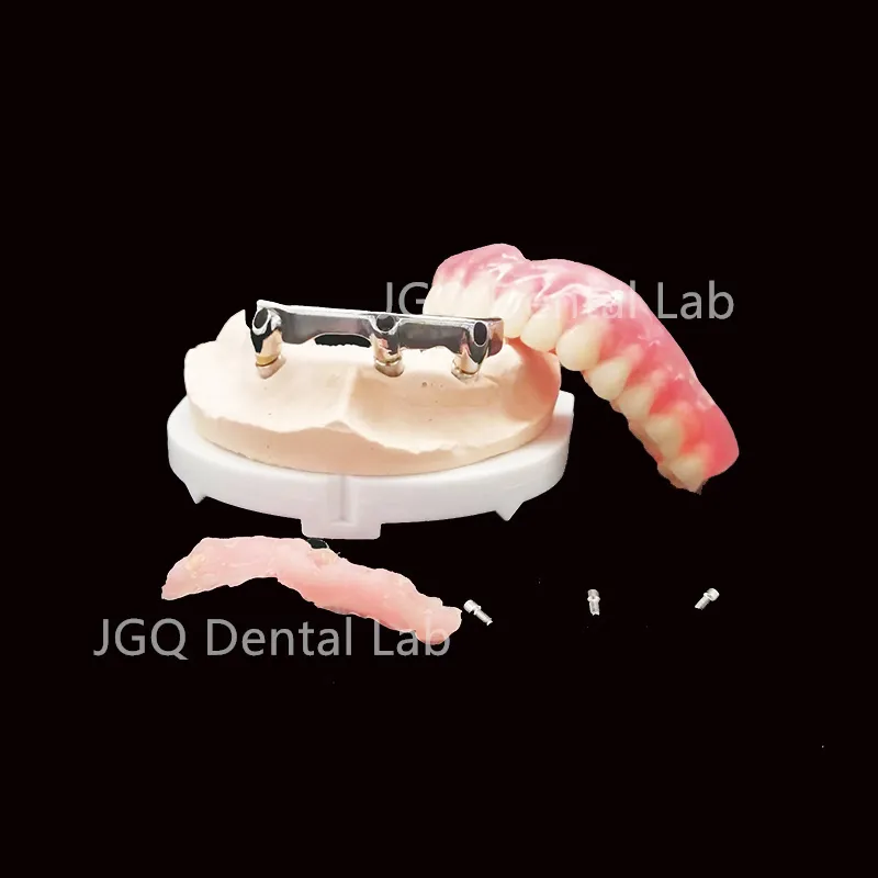 Custom Implant Bar