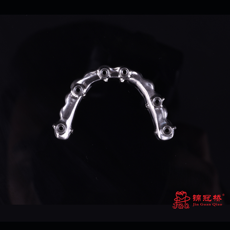 Dental Digital Titanium Implant Bar Malong Bridge with High 3D Printing Technology China Dental Laboratory