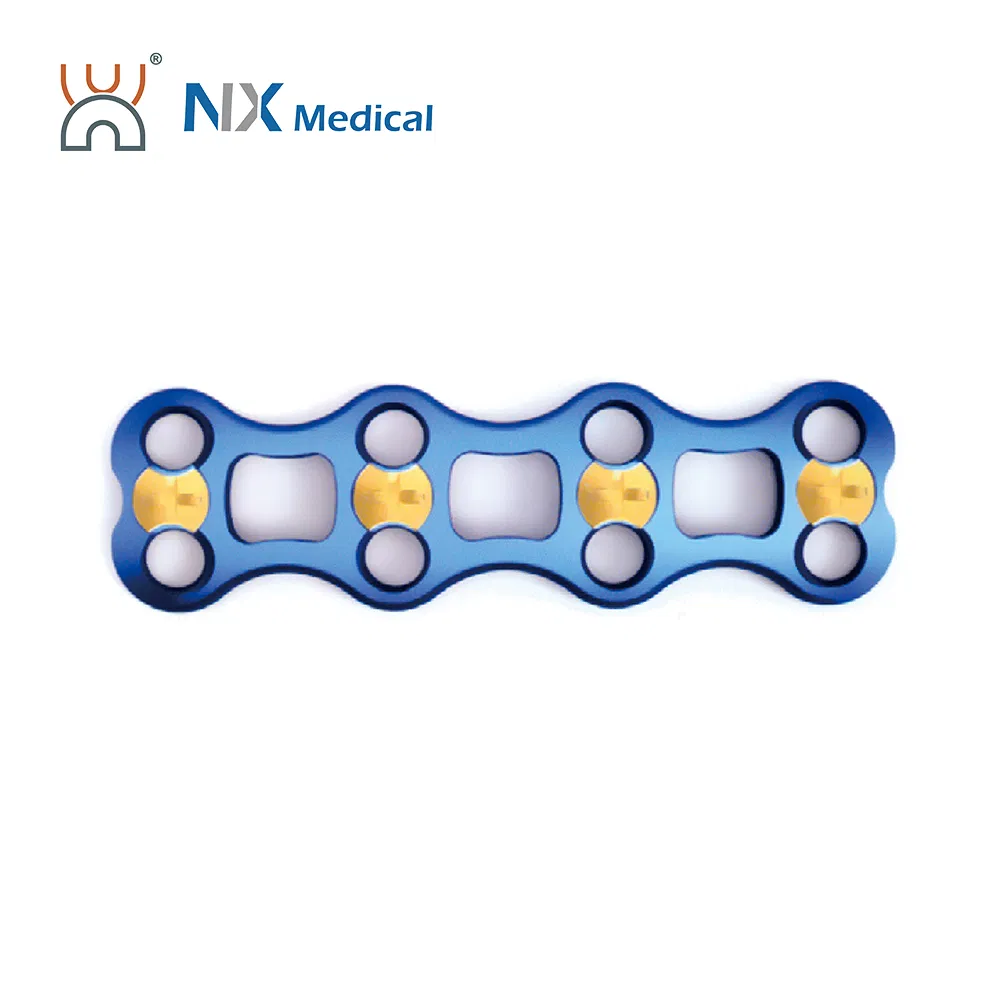 Nx Medical Titanium Orthopedic Implant Anterior Cervical Plate Spine Internal Fixation for Bone Surgery