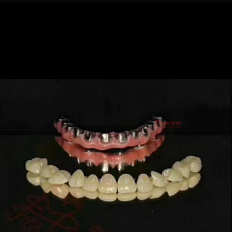 Dental Implant Hybrid Dentures with Titanium Bridge and Screwed Zircornia Crowns Lab China