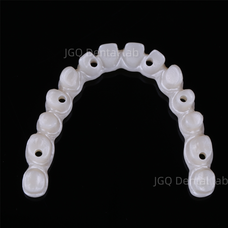 All on Dental Implants with Zircornia Abutment Dental Implant Titanium Bridges and Screwed Crowns