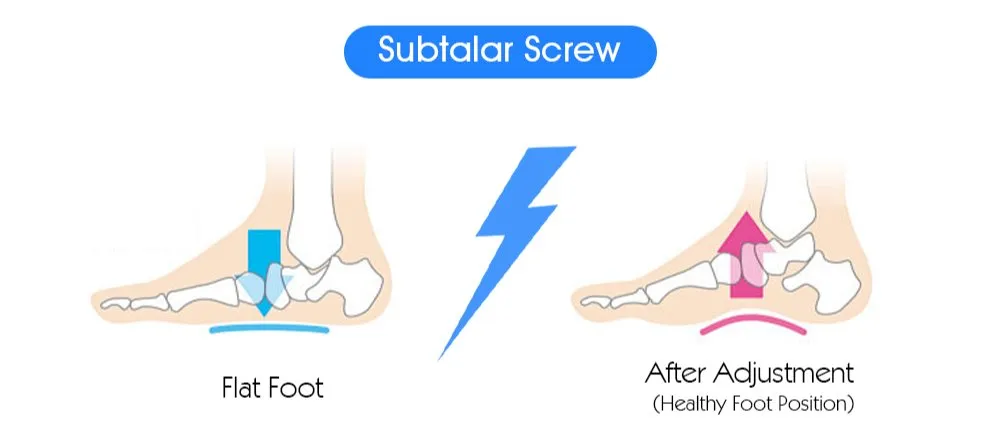 Orthopedic Screw Display