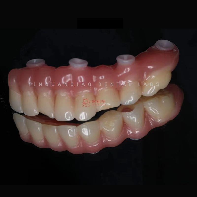 Dental Implant Hybrid Dentures with Titanium Bridge and Screwed Zircornia Crowns Lab China