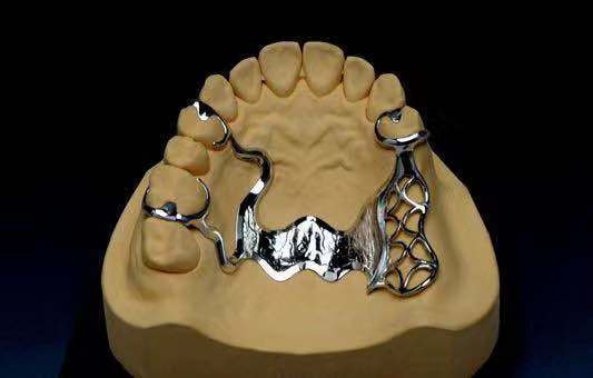 S. P. E Cobalt Chromium Dental Alloy