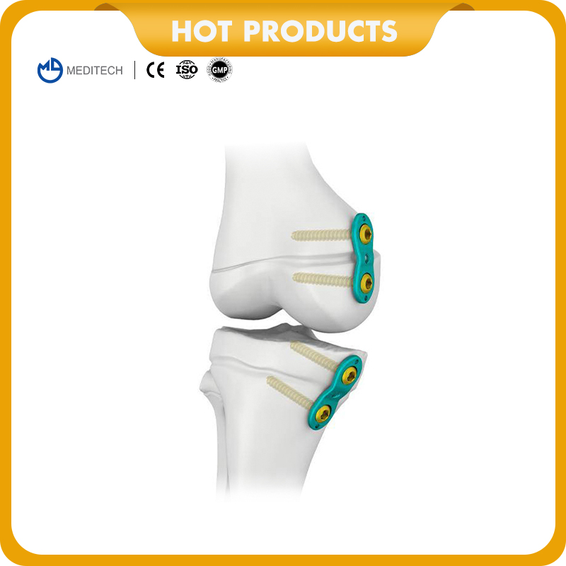 Orthopedic Implant Titanium Compression Locking Plate Pediatric Eight-Plate Guided Growth