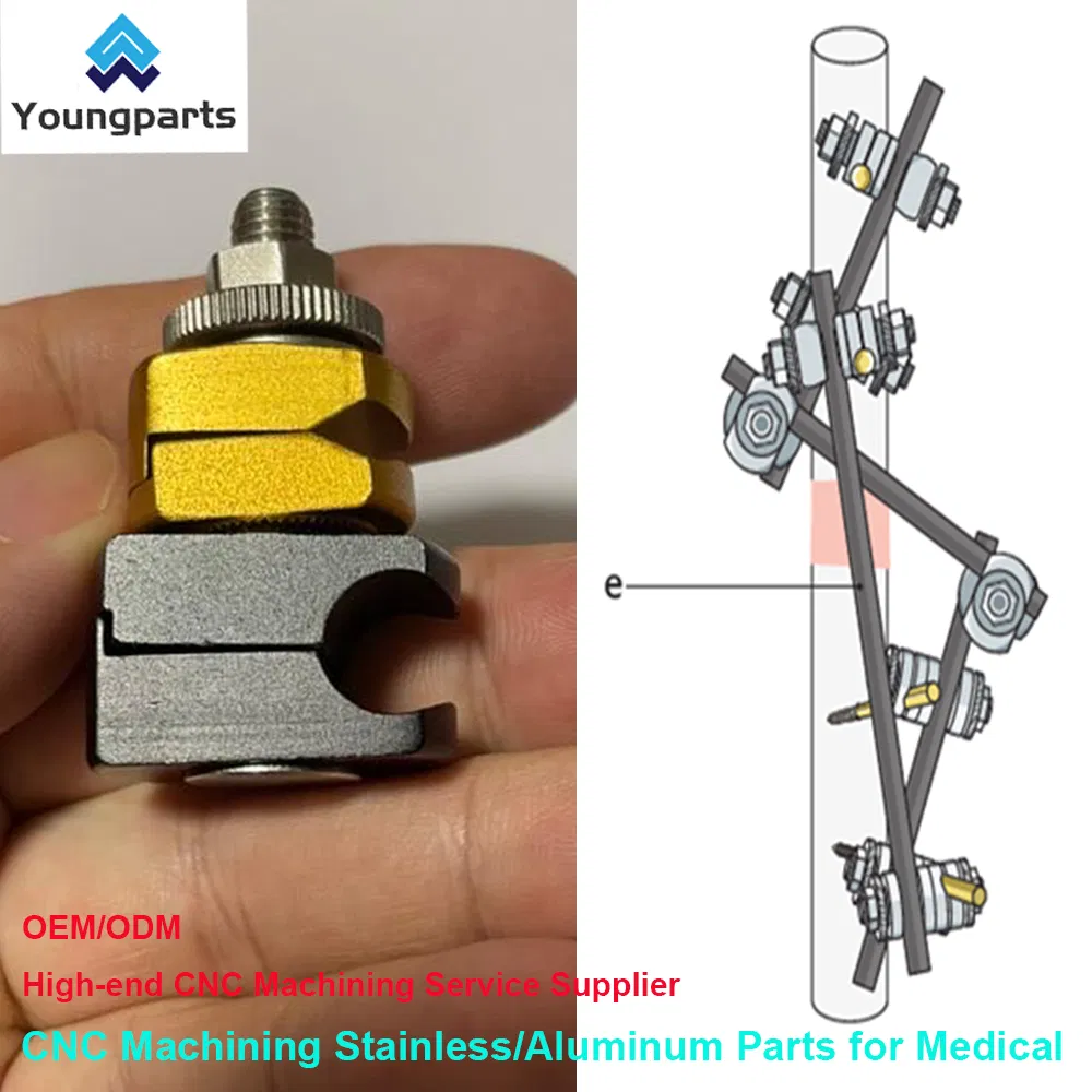 Bone Screws: Reliable Fastening Devices for Orthopedic Surgeries