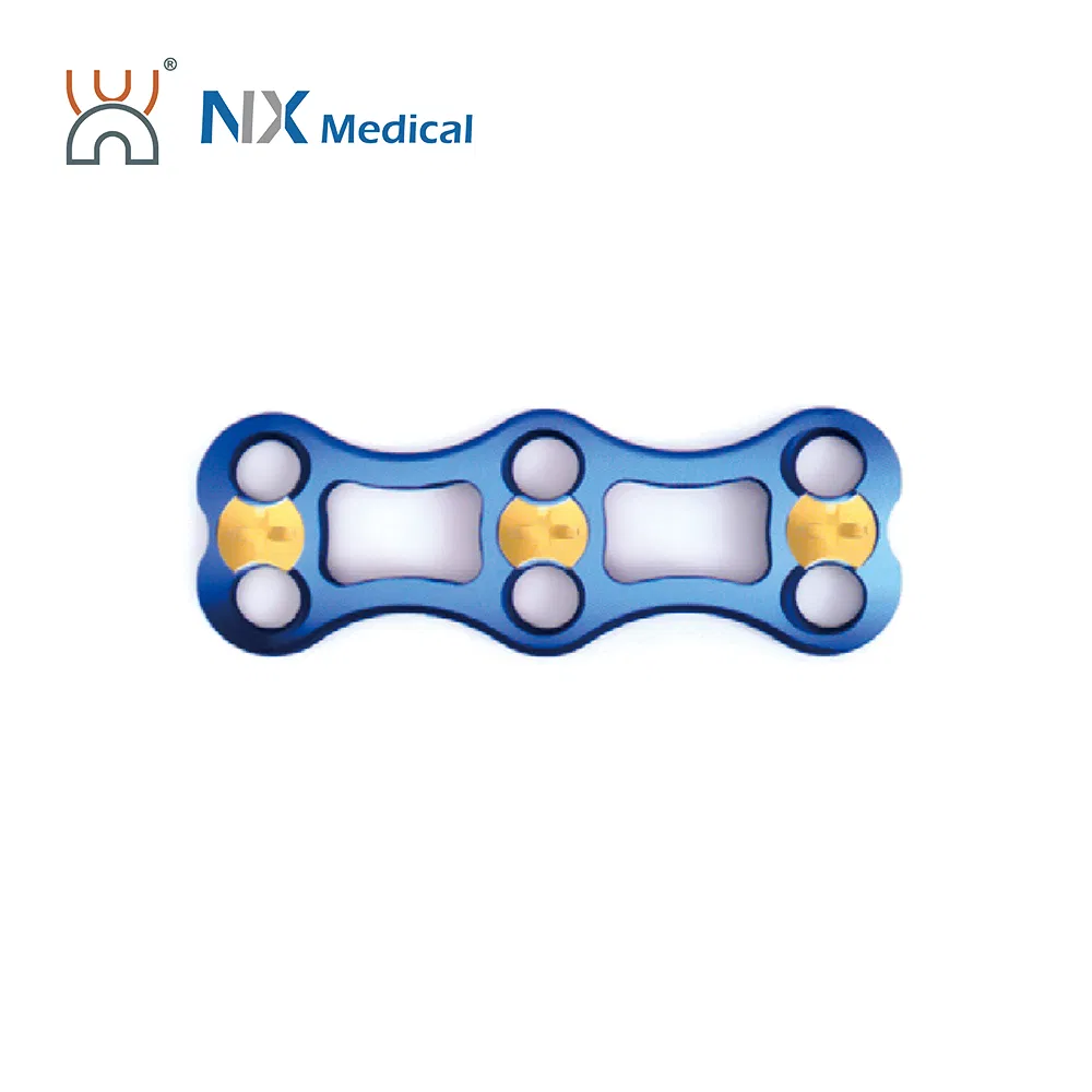 Nx Medical Titanium Orthopedic Implant Anterior Cervical Plate Spine Internal Fixation for Bone Surgery