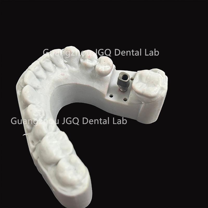 Dental Products Suppliers Customized Titanium Base and Fixed Zirconia Dentures Supported for Dental Implant