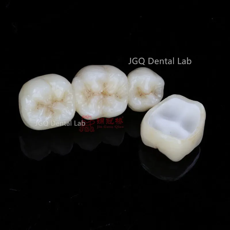 Zirconia Crown