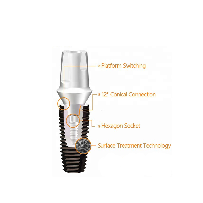 High Precise Dental Implant Pure Titanium OEM Tooth Fixture