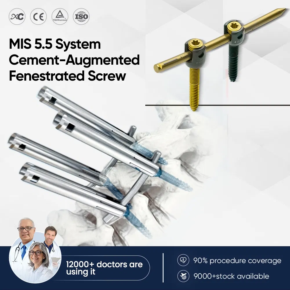 Spine Implant Screws