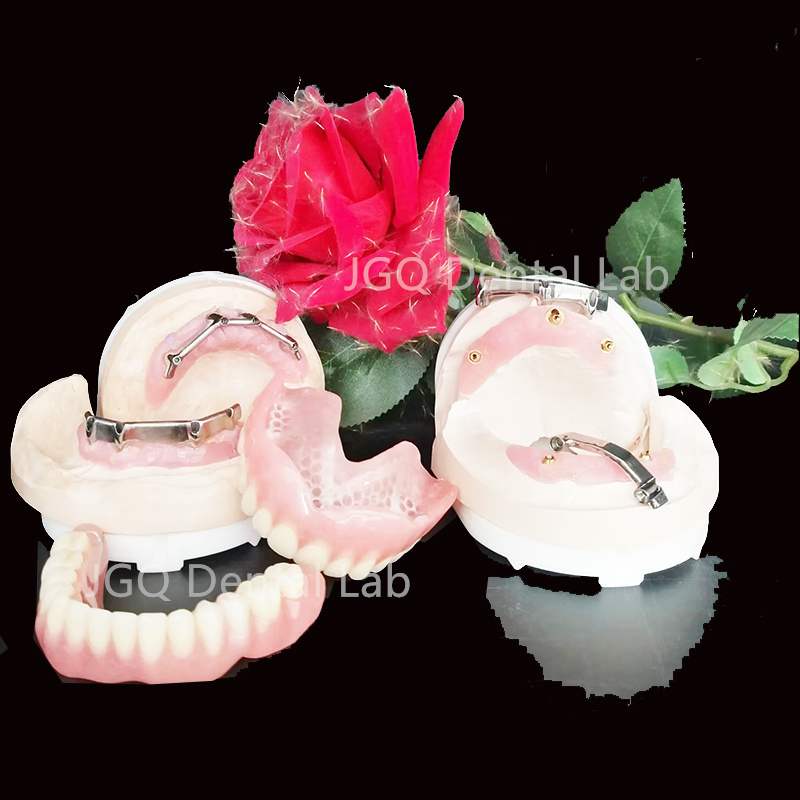 Full Service Implant Restorations Titanium Implant Bar Dental Lab with Stl Dcm Ply Case