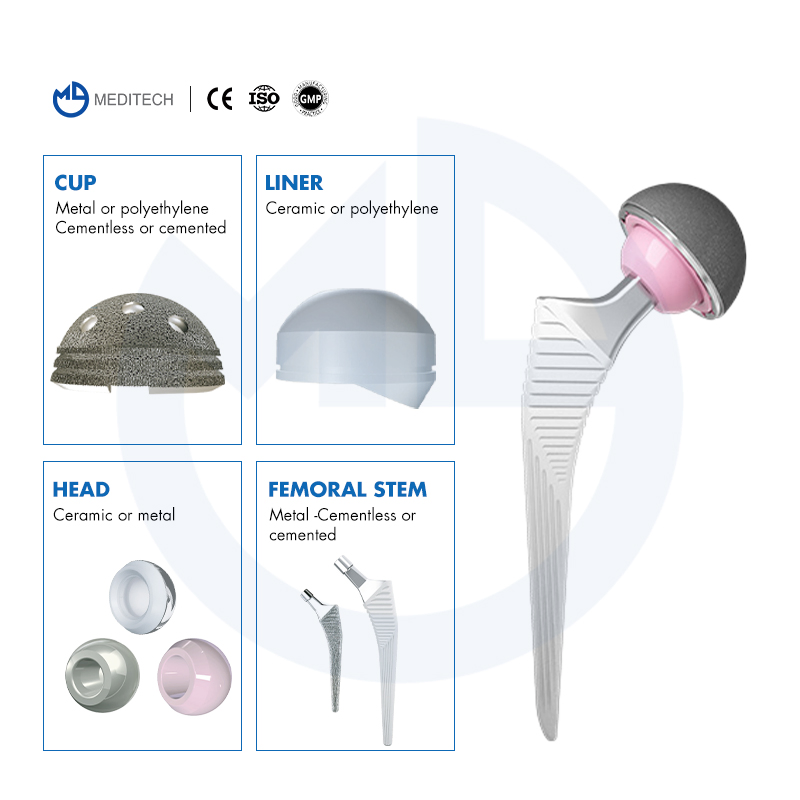 Orthopedic Implants Titanium Hip Prosthesis Replacement Devices Cementless Femoral Stem