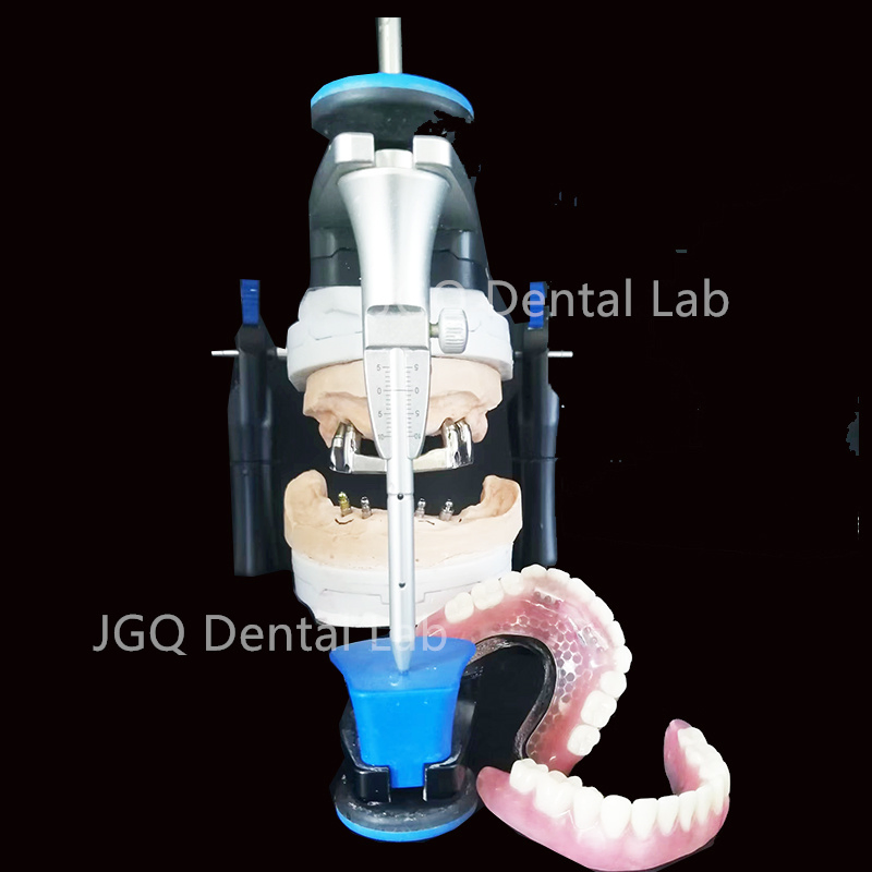 Full Service Implant Restorations Titanium Implant Bar Dental Lab with Stl Dcm Ply Case