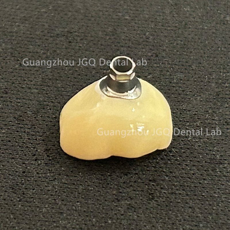 Dental Products Suppliers Customized Titanium Base and Fixed Zirconia Dentures Supported for Dental Implant