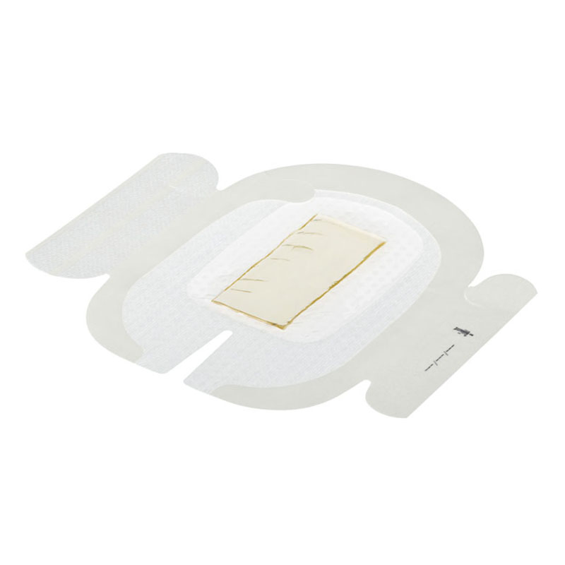 High Quality Chg IV Dressing for Preventing Infection at Insertion Sites