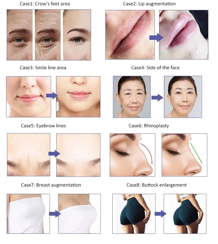 Face Application