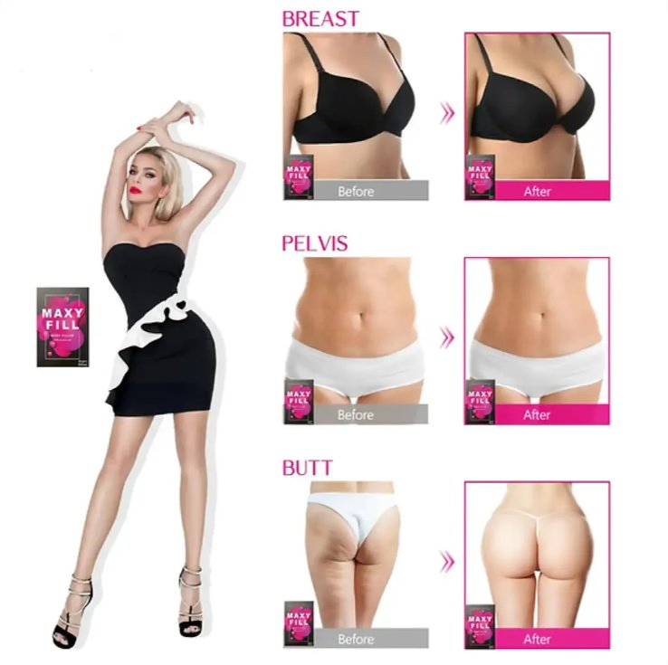 Maxy Fill 70 Cc Hyaluronic Acid Body Filler Injection for Breast Enhancement and Buttocks Lifting