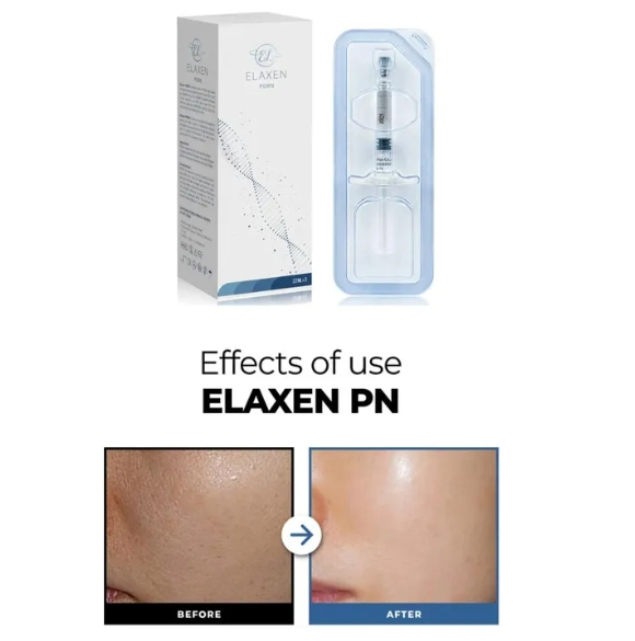 Hot Selling Elaxen Pn Dermal Filler Injection Hyaluronic Acid Anti-Wrinkle Removal Wrinkle Reduction Pore Removal Elaxen Pn Skin Booster