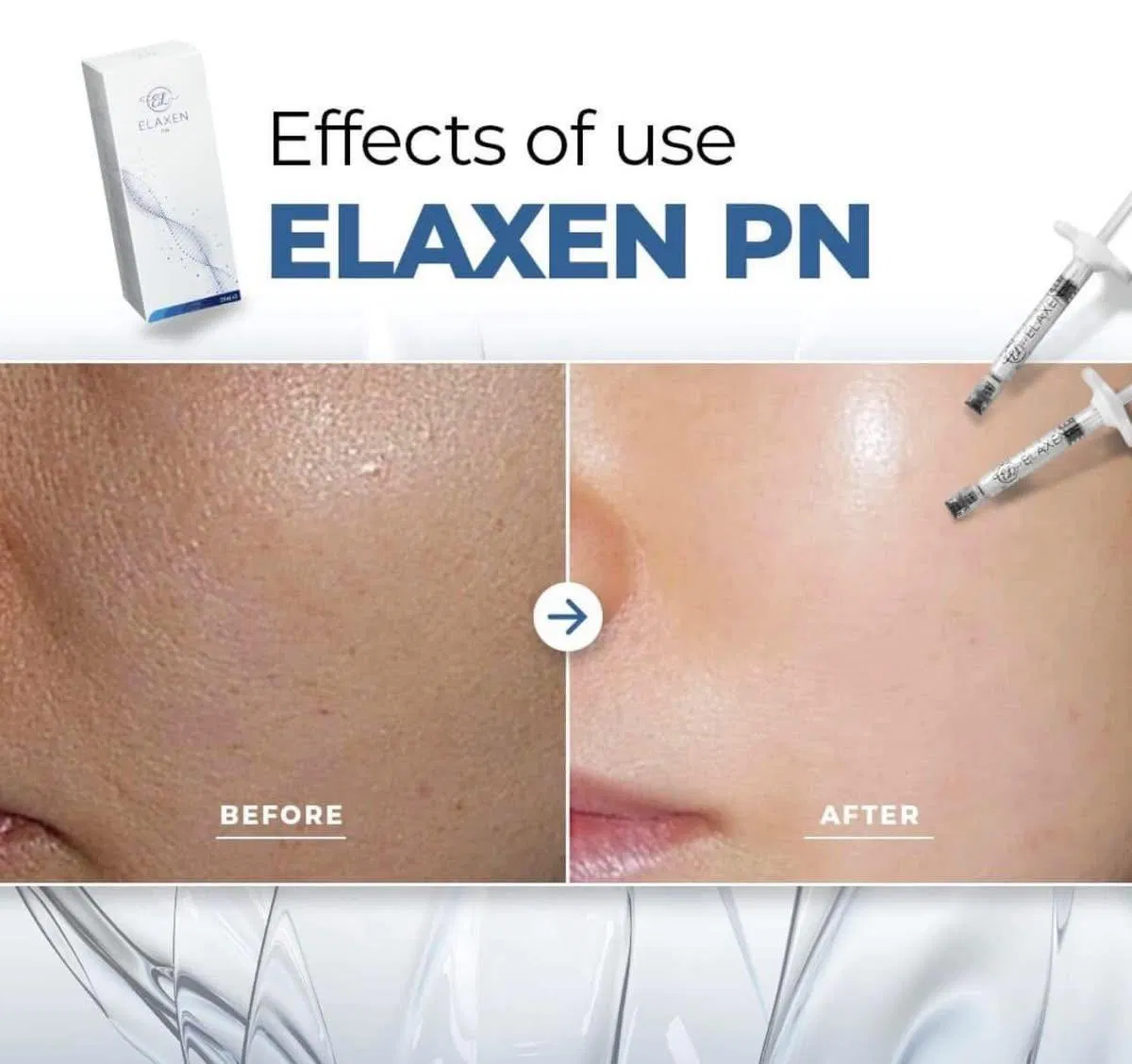 Elaxen Pn Skin Booster Luclane Pn Injection Illuma Pn Pdrn Skin Collagen Elaxen Pn Injection