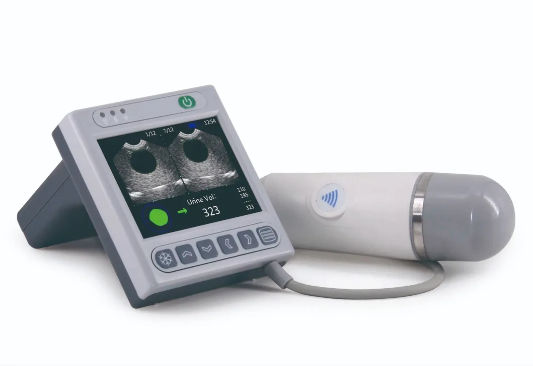 Medical Equipment Bladder Ultrasound Scanner