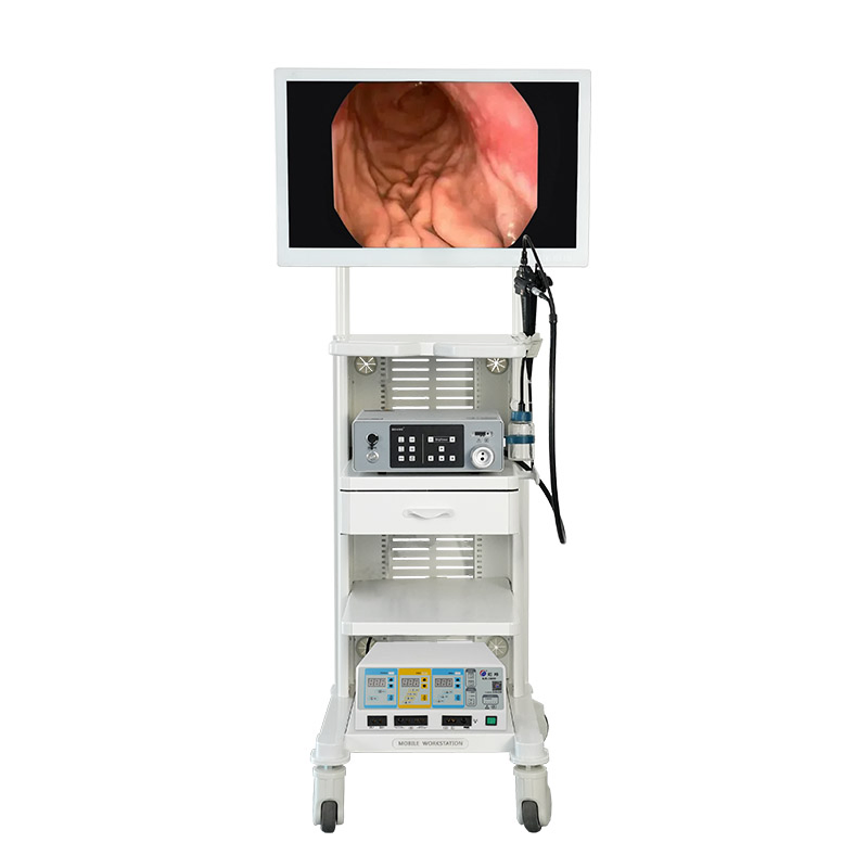 Advanced Geiwre Medical Endoscope System for Gastroenterology Procedures