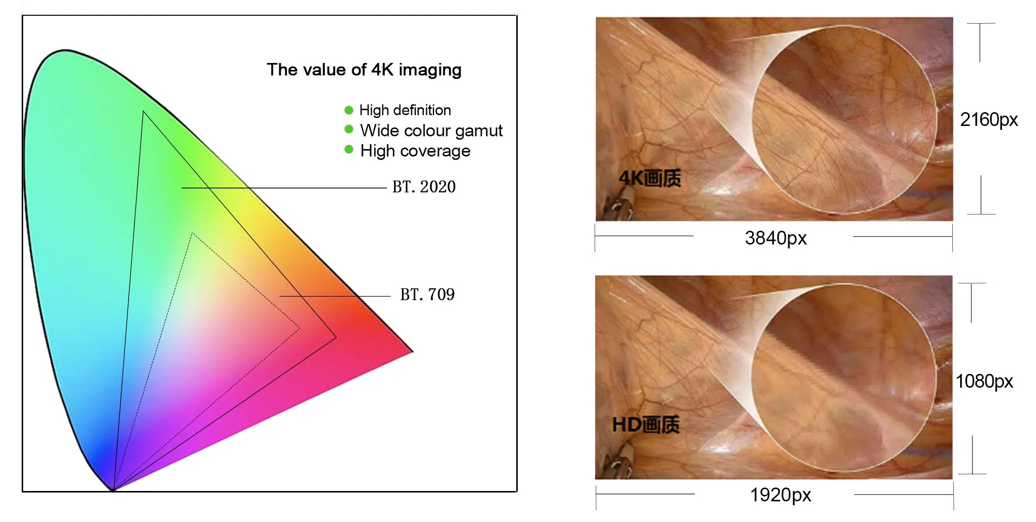 Advanced 4K Medical Endoscope System with Fluorescence Technology