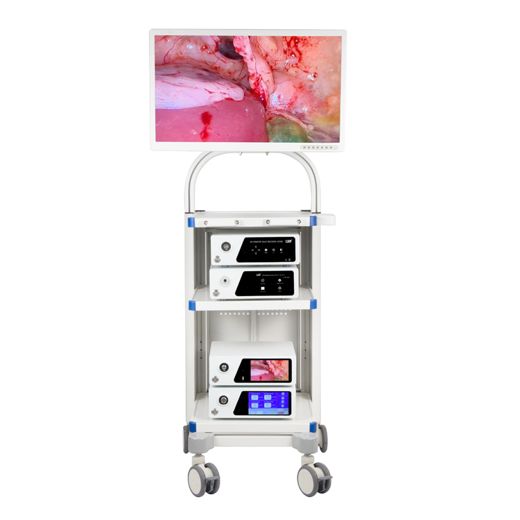 Medical Diagnostic Laparoscopy Endoscopic Instrument Endoscopy Equipment 4K Flourescent Endoscope Camera System