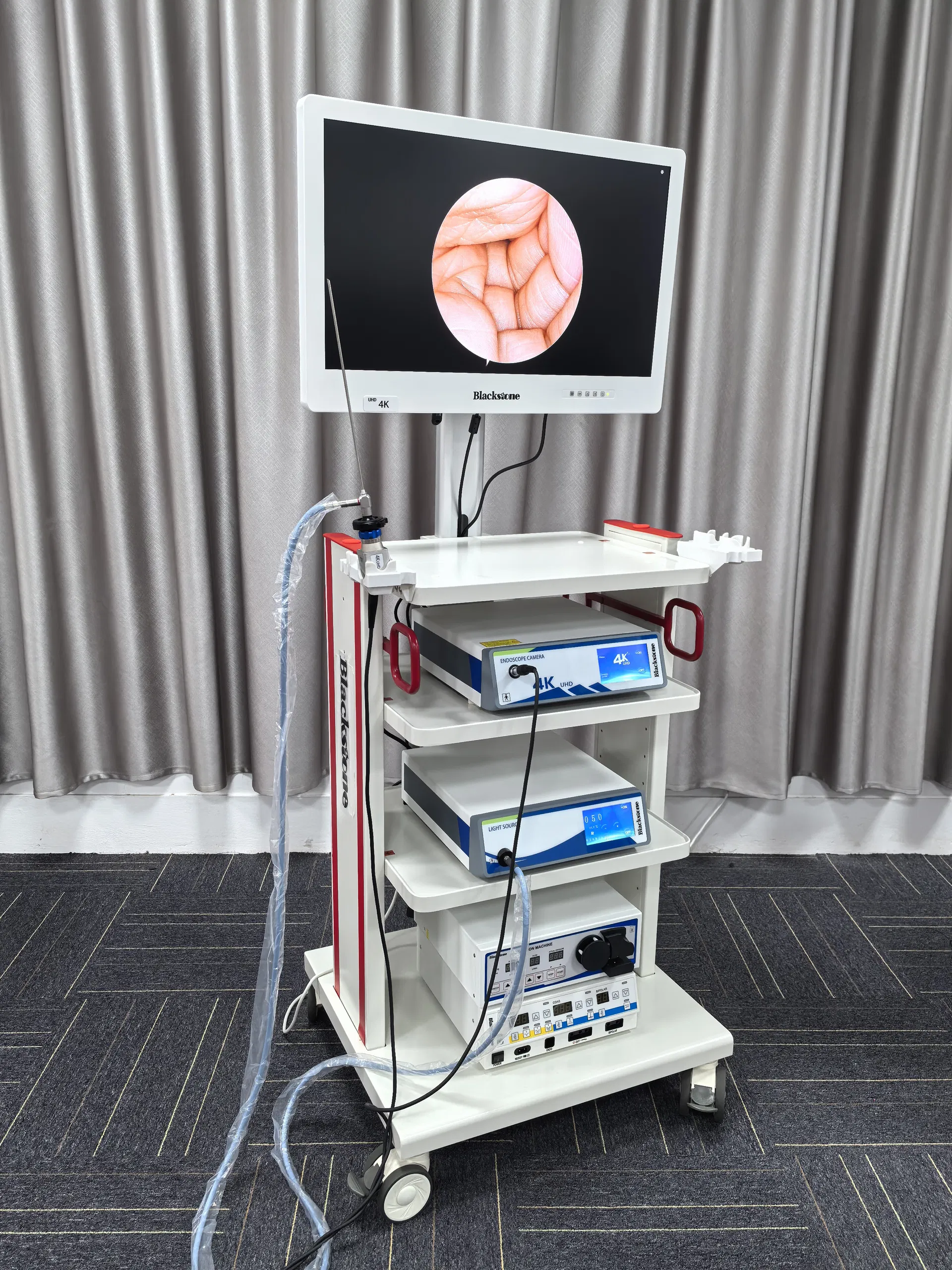 High-Definition Laparoscopic Endoscopic Imaging System for Surgical Operation