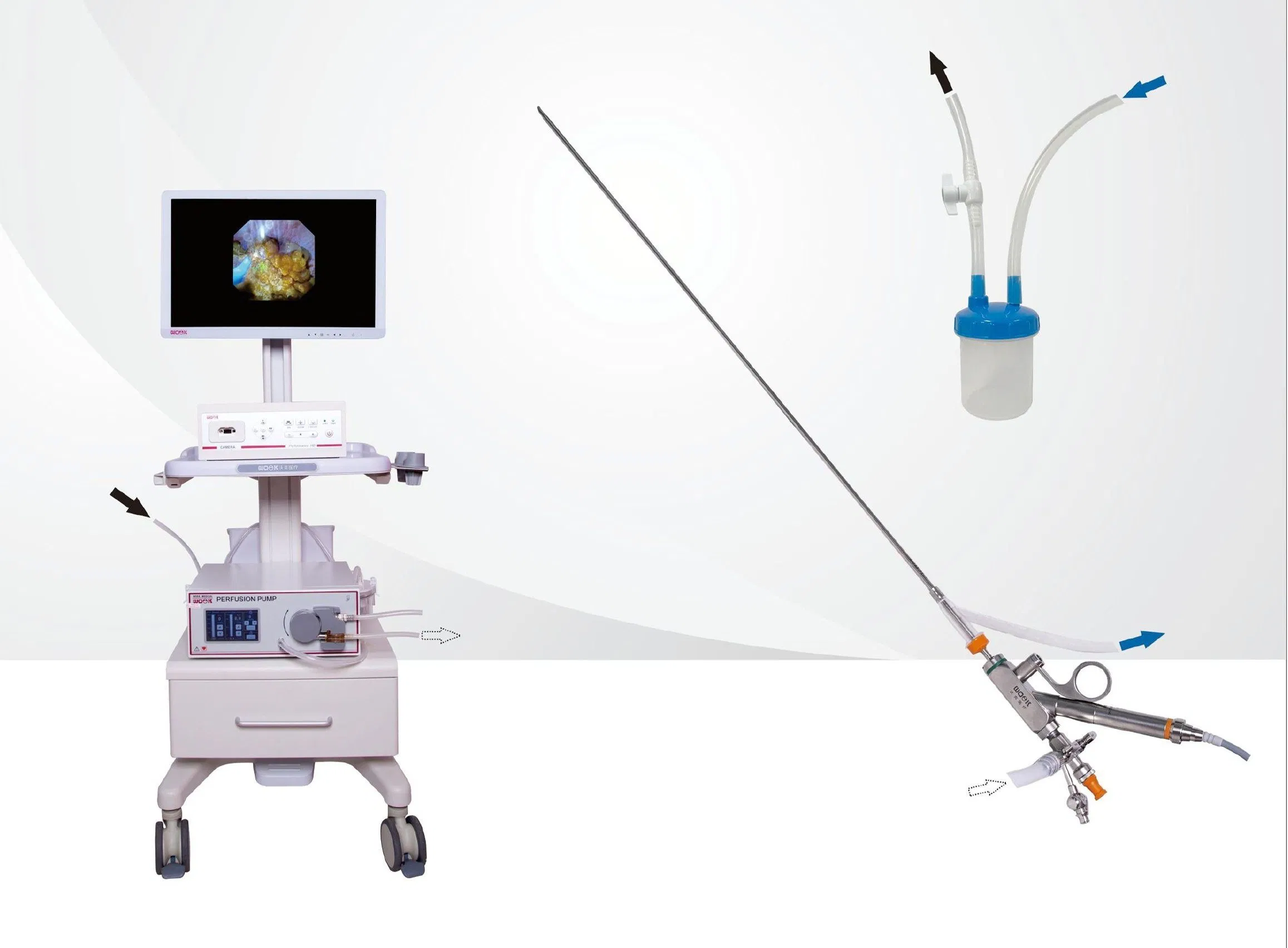 Digital Vontoscope Visual Sheathing Endscope &amp; Negative Pressure Lithotriptoscope System
