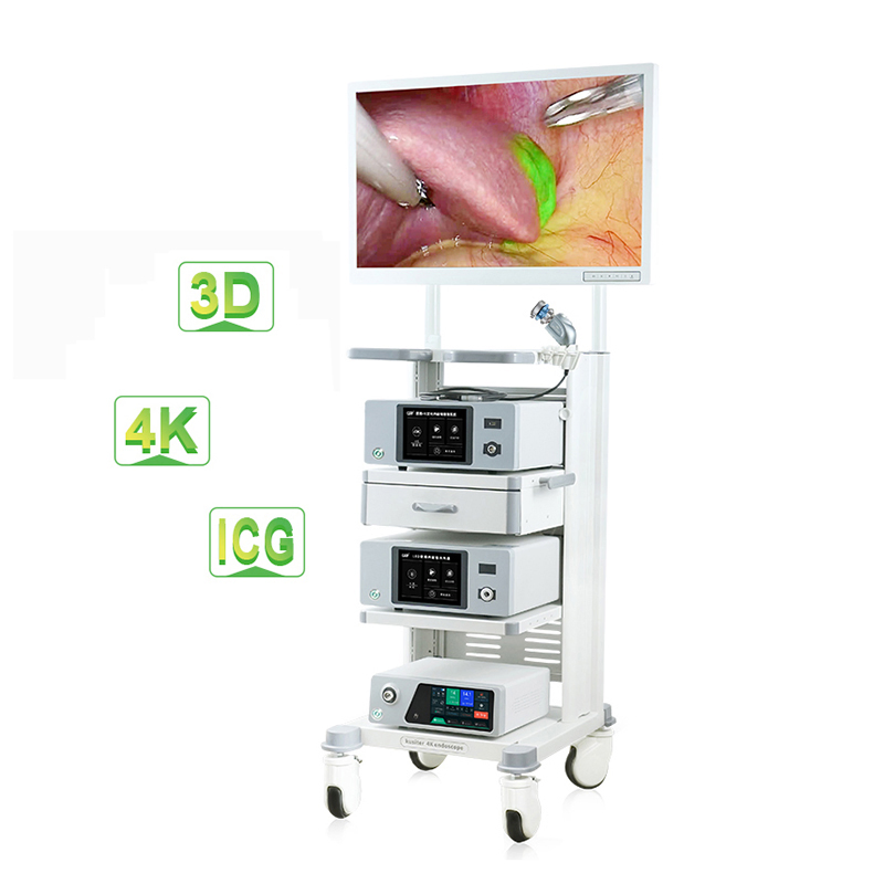 Advanced 4K Fluorescence Compatible Camera System with 9 000 000 Pixels 2*1/2.8 "CMOS for Abdominal Surgery