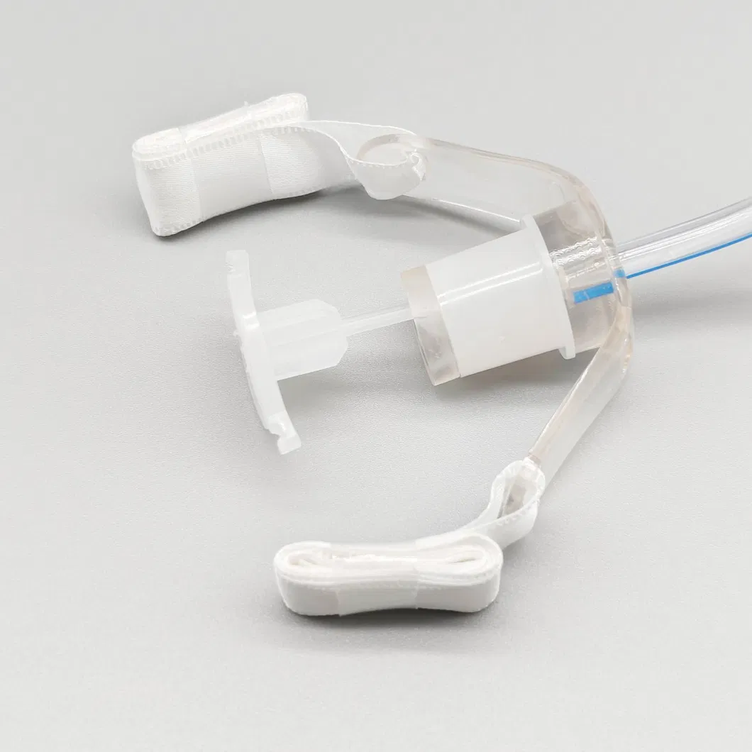 Tracheostomy Tube View 3