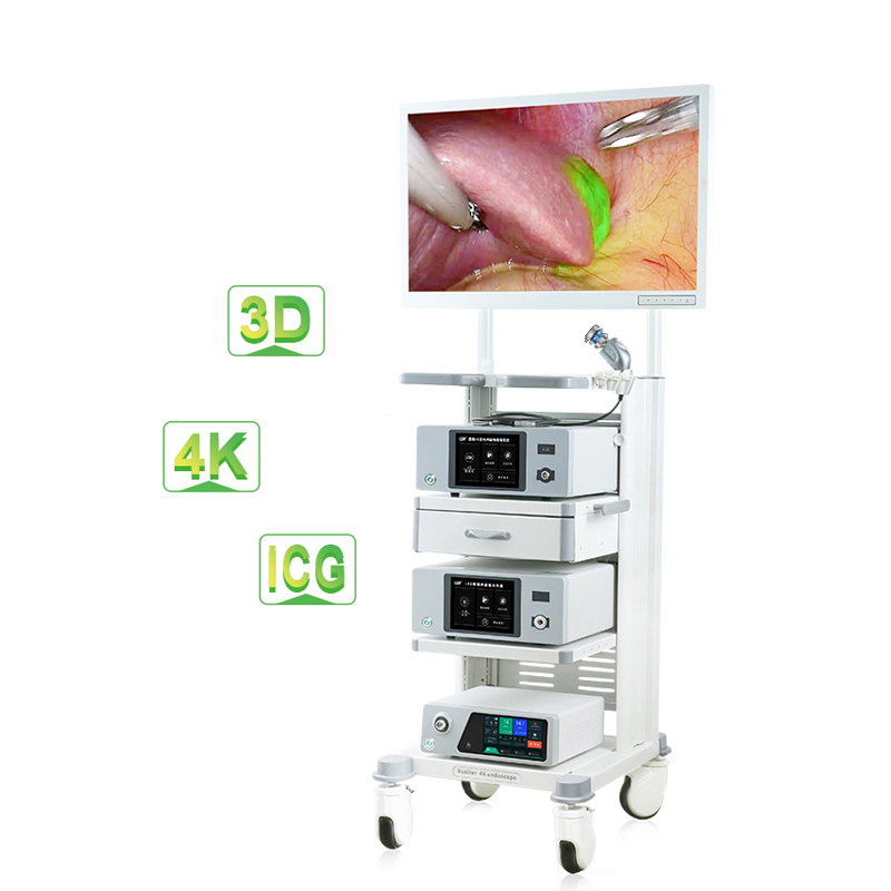 4K Fluorescent Medical Endoscope Camera System for Hysteroscopy Surgery