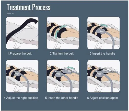 Treatment Method 2