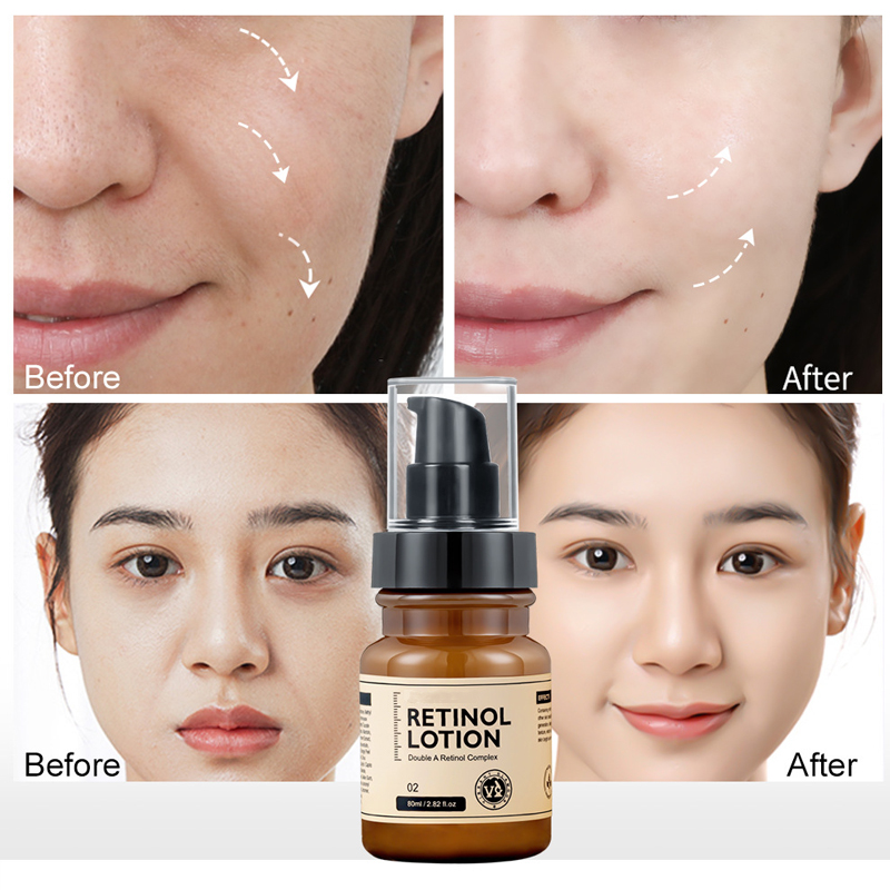 Vitamin Essence Milk Morning &amp; Night Reduce Fine Lines Moisturize Tighten Combat Early Aging OEM