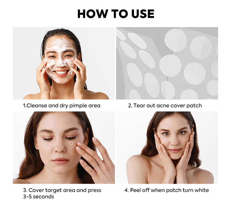 Acne Patch Feature 6