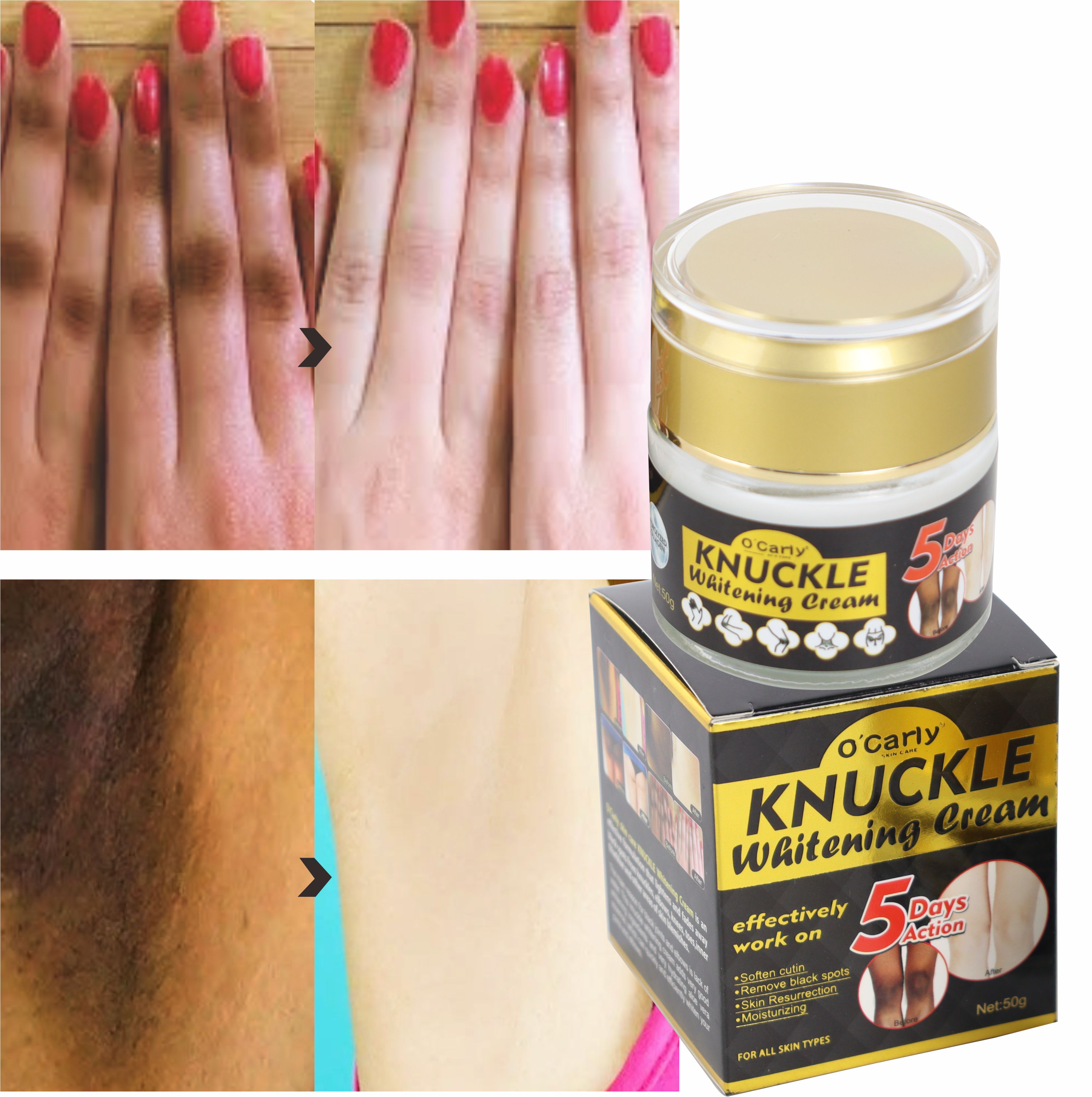 RTS Skincare (New) Private Label Hyaluronic Acid Knees Dark Elbows Lightening Skin Best Whitening Cream Dark Knuckles Removal