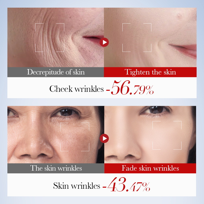 Facial Skin Care Products Wholesale Sensitive Skin Repair Face Serum Face Cream Lotion Snail Collagen Skin Care Set