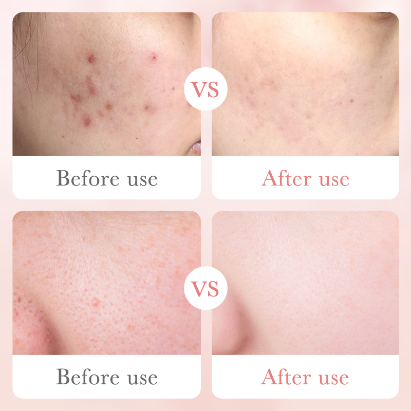 Natural Plant Extract Rose Skincare Set Whitening Private Label Hyaluronic Acid Vitamin C Serum Cream Skincare Kit Box