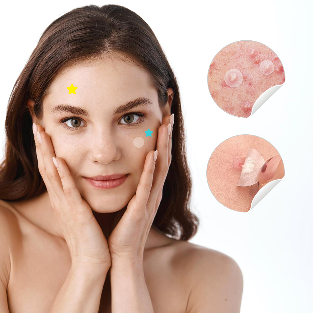 New Item OEM Waterproof Hydrocolloid Pimple Acne Patches Acne Pimple Cover Patch For Acne Treatment
