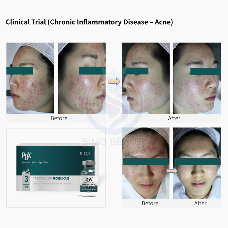 PDRN Solution Anti Inflammation Advanced Peptide Formula Dermatology Inspired Skincare for Weak Skin Barrier