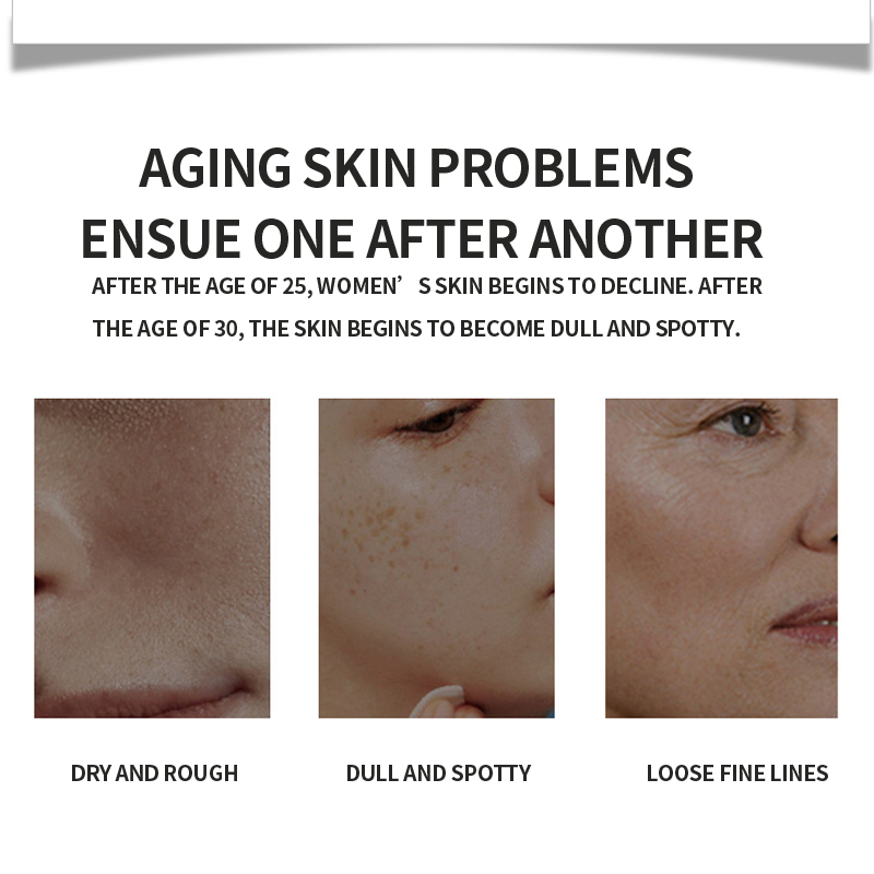 Niacinamide Brightening Moisturizing Skin Care Set Organic Freckles Remover Cream Kit Natural Beauty Gift Set OEM/ODM