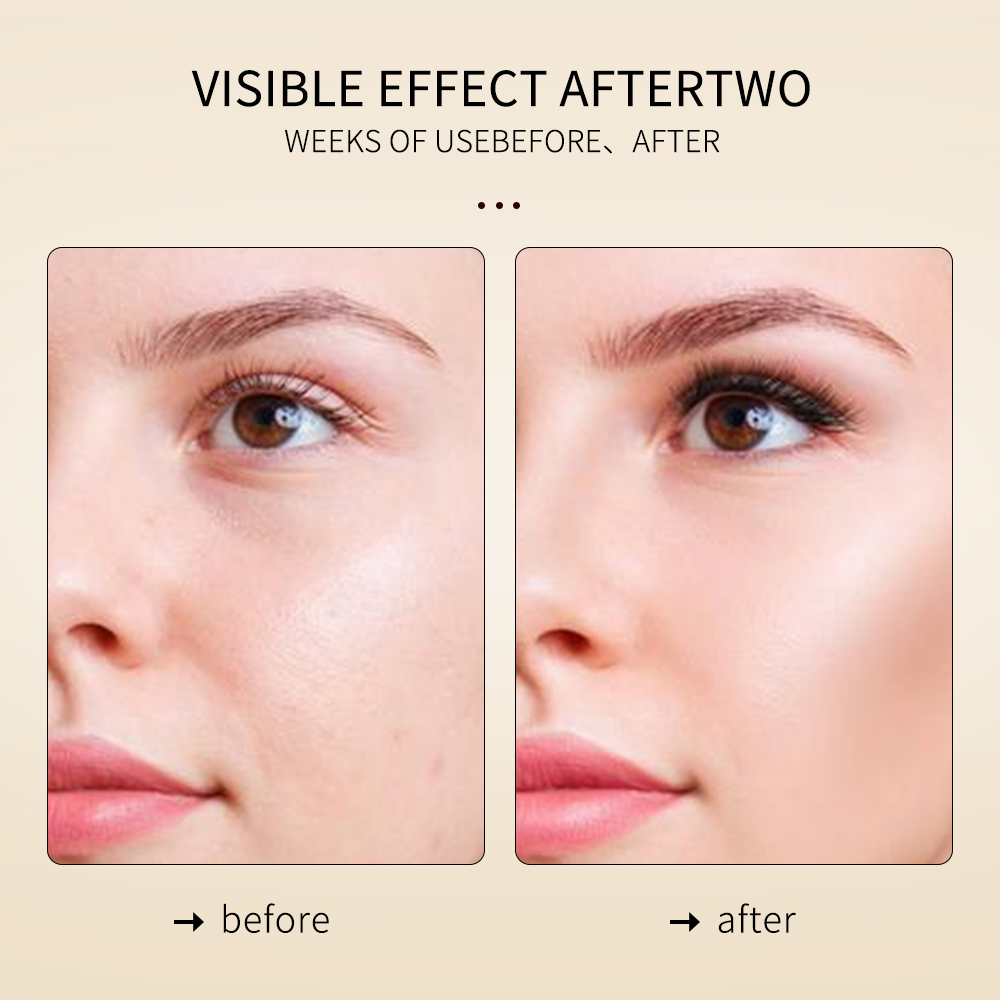 Krone Custom Natural Peony Root Extract Hyaluronic Acid Niacinamide Brightening Hydrating Moisturizing Serum Skin Care Set