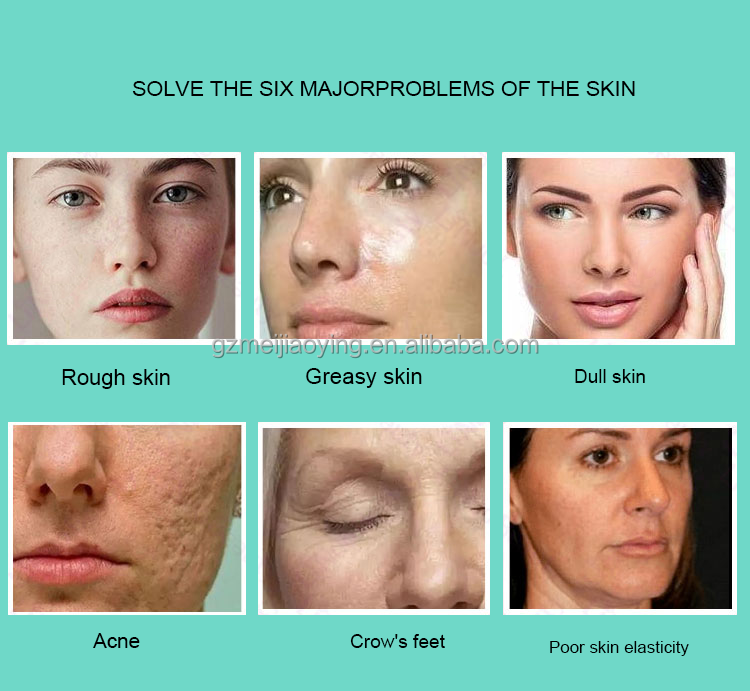 Dermabrasion Facial machine design 2