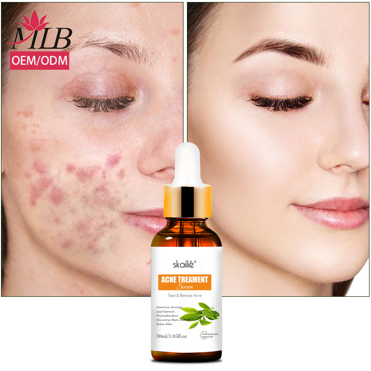 Ready to Ship Private Label Natural Plant Moisturizing Hydrating Repair Face Tea Tree Acne Serum